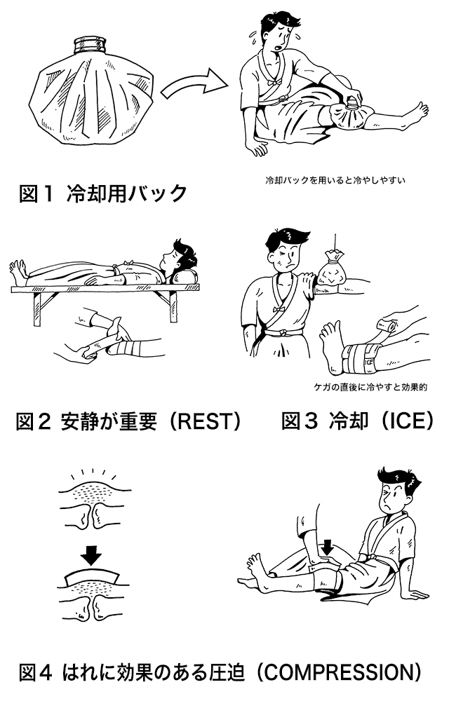 Rice処置 主なケガの応急処置 前編 全日本剣道連盟 Ajkf