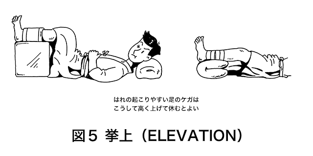 Rice処置 主なケガの応急処置 前編 全日本剣道連盟 Ajkf