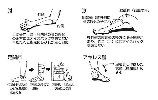 Rice処置 主なケガの応急処置 前編 全日本剣道連盟 Ajkf