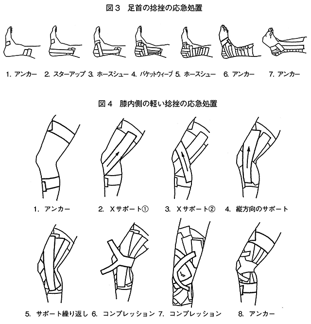 テーピング 簡単 捻挫 足首